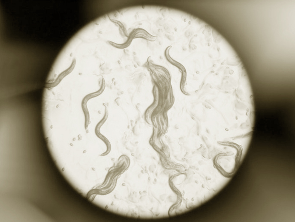 Image of a population of Caenorhabditis elegans taken through a stereomicroscope.